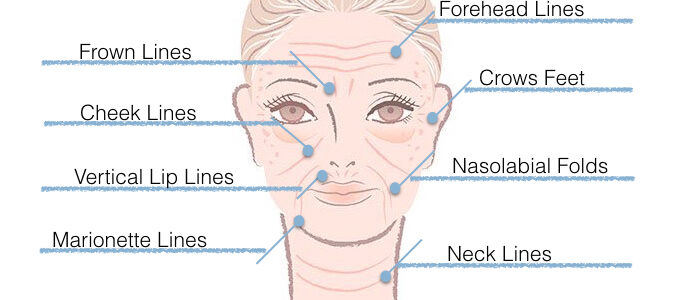Wrinkles: Causes & Natural Care